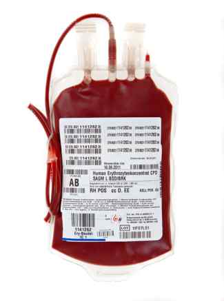Das Bild zeigt einen Blutbeutel in roter Farbe.